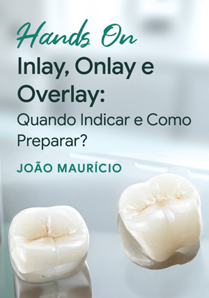 Cover for Hands-on: Inlay, Onlay e Overlay: quando indicar e como preparar?