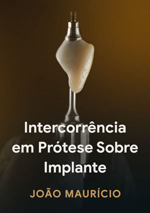 Cover for Intercorrência em Prótese sobre Implante