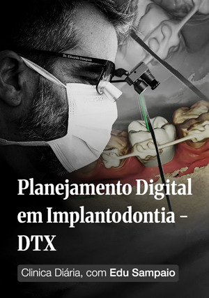 Cover for Planejamento Digital em Implantodontia - DTX