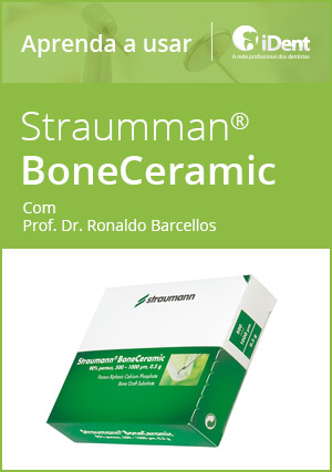 Cover for Aprenda a usar: BoneCeramic da Straumann