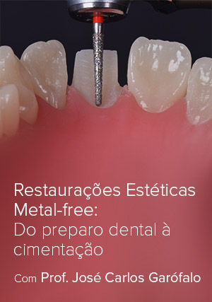 Cover for Restaurações Estéticas Metal-free: Do preparo dental à cimentação