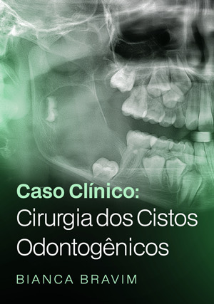 Cover for Caso Clínico: Cirurgia dos Cistos Odontogênicos