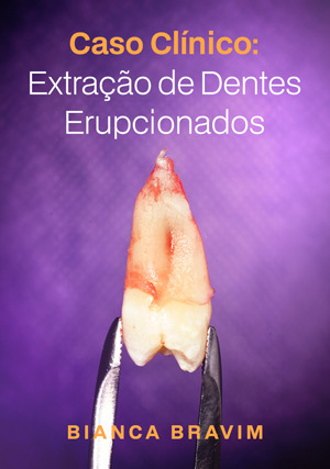 Cover for Caso Clínico: Extração de Dentes Erupcionados