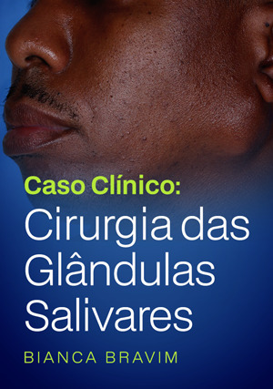 Cover for Caso Clínico: Cirurgia das Glândulas Salivares