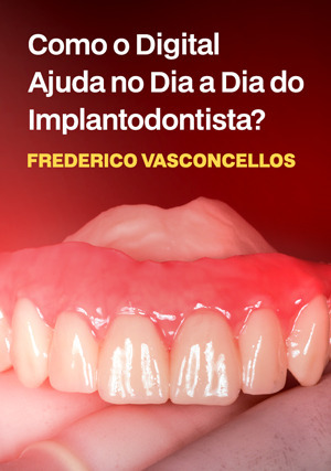 Cover for Como o digital ajuda no dia a dia do Implantodontista?