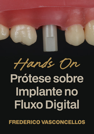 Cover for Hands on: Prótese sobre Implante no Fluxo Digital