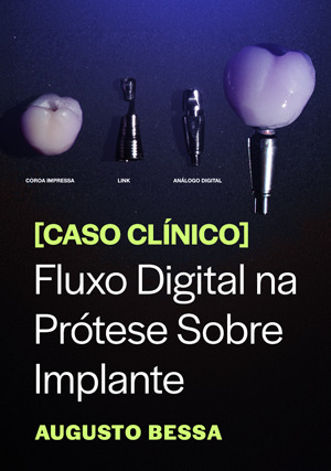Cover for Caso Clínico: Fluxo Digital na Prótese sobre Implante