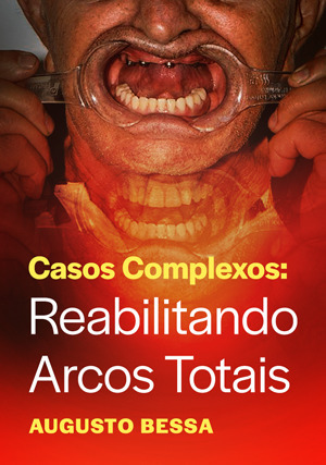 Cover for Casos Complexos: Reabilitando Arcos Totais