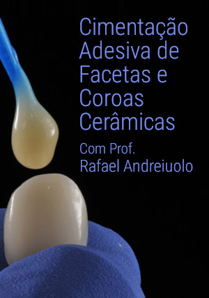 Cover for Cimentação Adesiva de Facetas e Coroas Cerâmicas