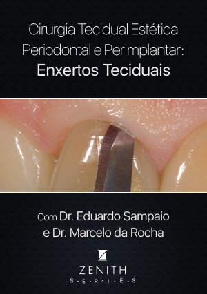 Cover for Cirurgia Tecidual Estética Periodontal e Peri-implantar: Enxertos Teciduais