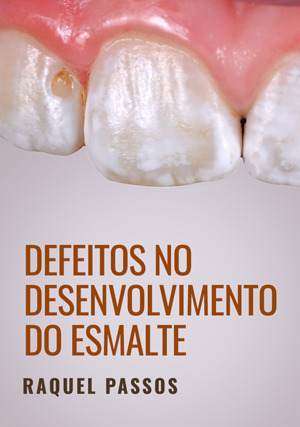 Cover for Defeitos no Desenvolvimento do Esmalte
