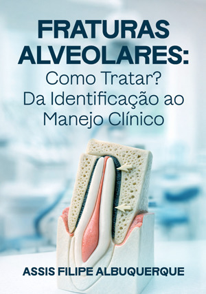 Cover for Fraturas Alveolares: Como Tratar? Da Identificação ao Manejo Clínico