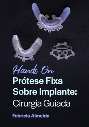 Cover for Hands on - Prótese Fixa sobre Implante: Cirurgia Guiada