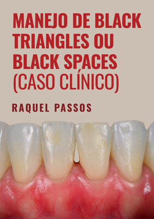 Cover for Manejo de Black Triangles ou Black Spaces (Caso Clínico)