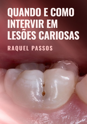 Cover for Quando e Como intervir em Lesões Cariosas