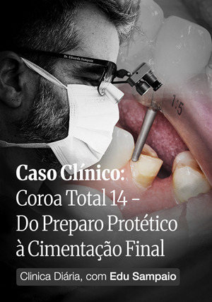 Cover for Clínica Diária, com Edu Sampaio - Caso Clínico: Coroa total 14 - Do Preparo protético à cimentação final