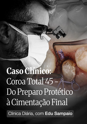 Cover for Clínica Diária, com Edu Sampaio - Caso Clínico: Coroa total 45 - Do Preparo protético à cimentação final