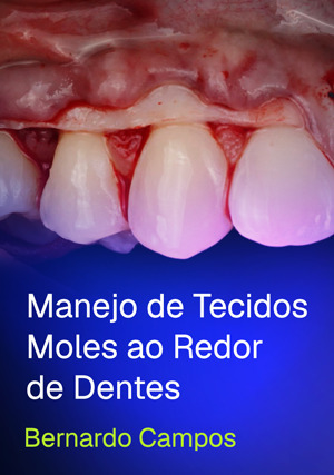Cover for Manejo de Tecidos Moles ao Redor de Dentes