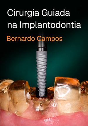 Cover for Cirurgia Guiada na Implantodontia