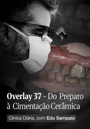 Cover for Clínica Diária, com Edu Sampaio - Overlay 37 - Do Preparo à Cimentação Cerâmica