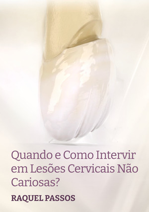 Cover for Quando e como intervir em Lesões Cervicais Não cariosas?