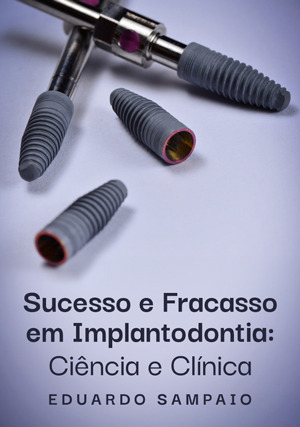 Cover for Sucesso e Fracasso em Implantodontia: Ciência e Clínica