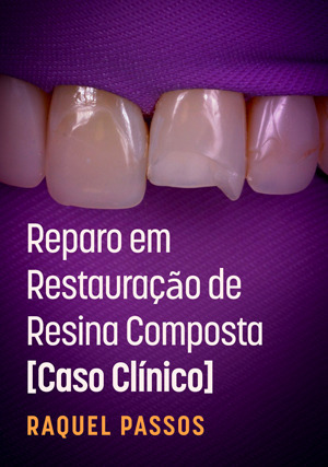 Cover for Reparo em Restauração de Resina Composta - Caso Clínico