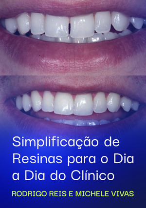 Cover for Simplificação de Resinas para o Dia a Dia do Clínico