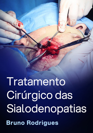 Cover for Tratamento Cirúrgico das Sialodenopatias