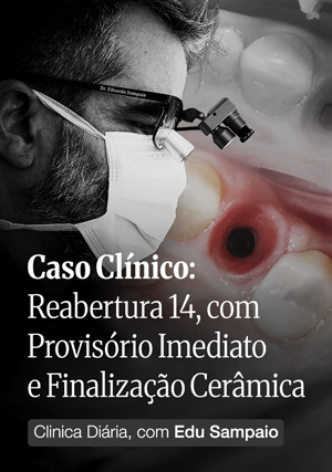 Cover for Clínica Diária, com Edu Sampaio - Caso Clínico: Reabertura 14, com Provisório Imediato e Finalização Cerâmica