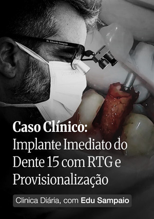 Cover for Clínica Diária, com Edu Sampaio - Caso Clínico: Implante Imediato do Dente 15 com RTG e Provisionalização