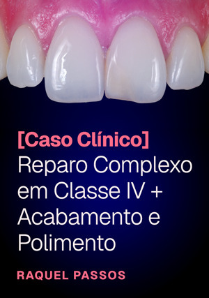 Cover for Reparo Complexo em Classe IV + Acabamento e Polimento