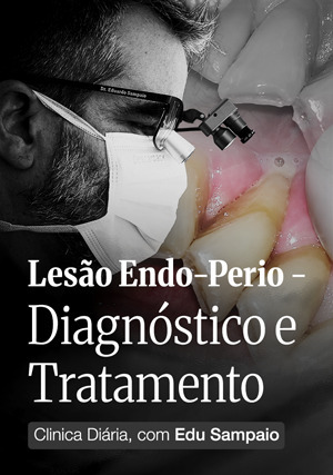 Cover for Clínica Diária, com Edu Sampaio: Lesão endo-perio - Diagnóstico e Tratamento