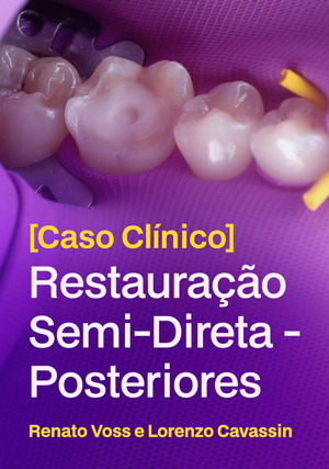 Cover for Caso Clínico: Restauração Semi-Direta - Posteriores