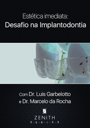 Cover for Estética Imediata: Desafio na Implantodontia