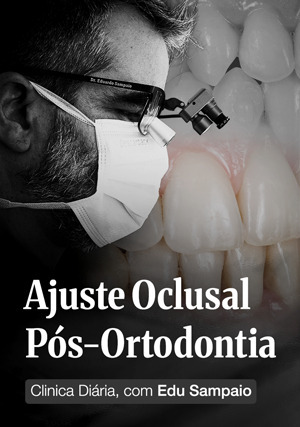 Cover for Clínica Diária com Edu Sampaio: Ajuste Oclusal Pós-ortodontia