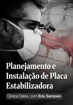 Cover for Clínica Diária com Edu Sampaio: Planejamento e Instalação de Placa Estabilizadora