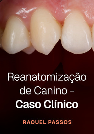 Cover for Reanatomização de Canino - Caso clínico