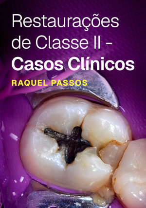 Cover for Restaurações de Classe II - Casos Clínicos