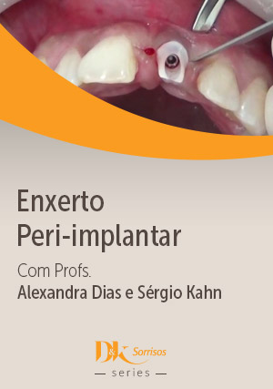 Cover for Enxerto Peri-implantar