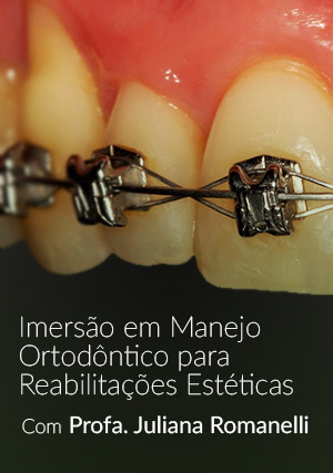 Cover for Imersão em Manejo Ortodôntico para Reabilitações Estéticas