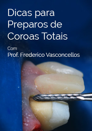 Cover for Dicas para Preparos de Coroas Totais