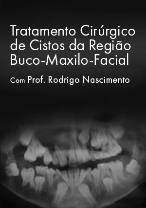Cover for Tratamento Cirúrgico de Cistos da Região Buco-Maxilo-Facial