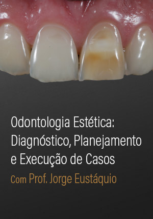 Cover for Odontologia Estética: Diagnóstico, planejamento e execução de casos
