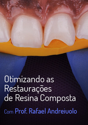 Cover for Otimizando as Restaurações de Resina Composta
