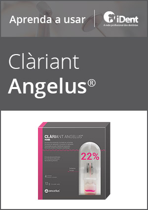 Cover for Aprenda a usar: Clàriant da Angelus