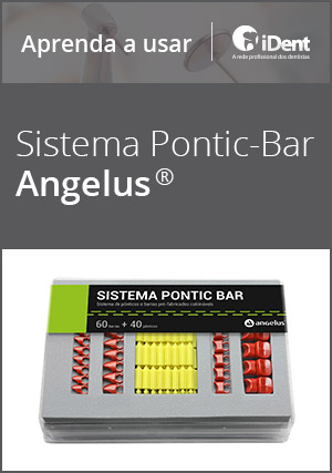 Cover for Aprenda a usar: Sistema Pontic Bar da Angelus