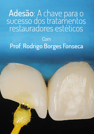 Cover for Adesão: A chave para o sucesso dos tratamentos restauradores estéticos