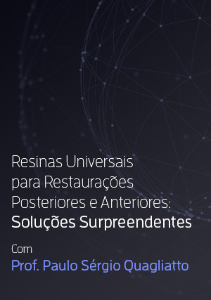 Cover for Resinas Universais para Restaurações Posteriores e Anteriores - Soluções Surpreendentes