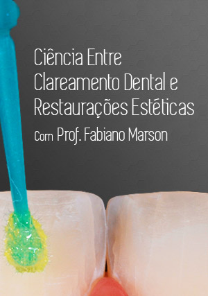 Cover for Ciência Entre Clareamento Dental e Restaurações Estéticas